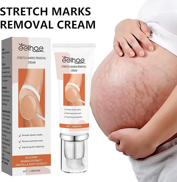 Eelhoe - Stretch Marks Removal Cream (Original)