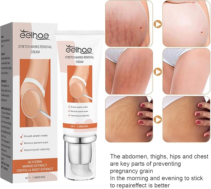 Eelhoe - Stretch Marks Removal Cream (Original)
