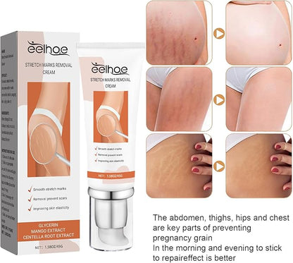 Eelhoe - Stretch Marks Removal Cream (Original)